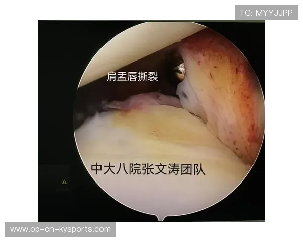 推动运动医学成果科普内容向公众传播的平台，运动医学科普文章